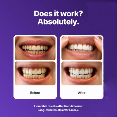 MilkyStrips® - Purple Teeth Whitening Strips